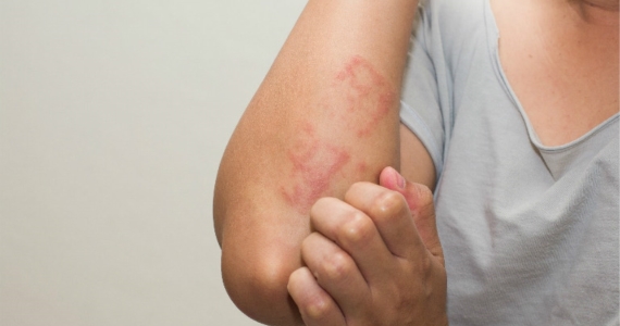 Chăm sóc cổ vai gáy